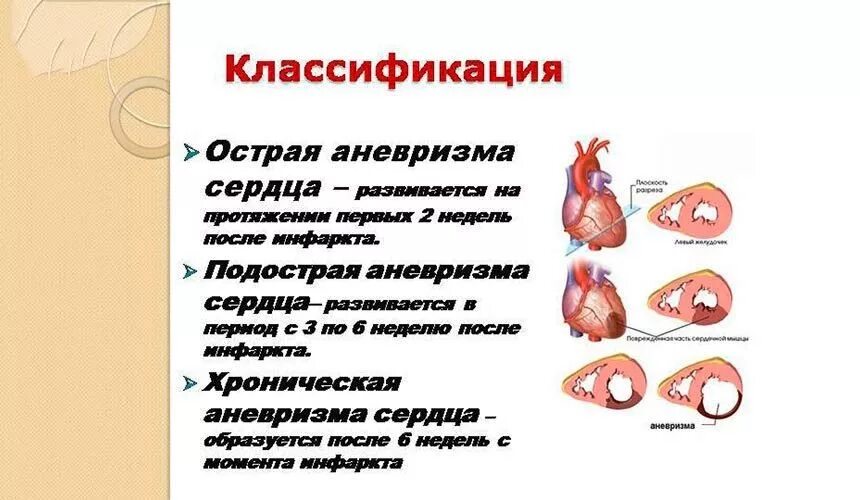 Аневризма сердца что это такое симптомы. Аневризма левого желудочка клиника. Постинфарктная аневризма классификация. Хроническая аневризма сердца патогенез. Постинфарктная аневризма сердца диагностика.