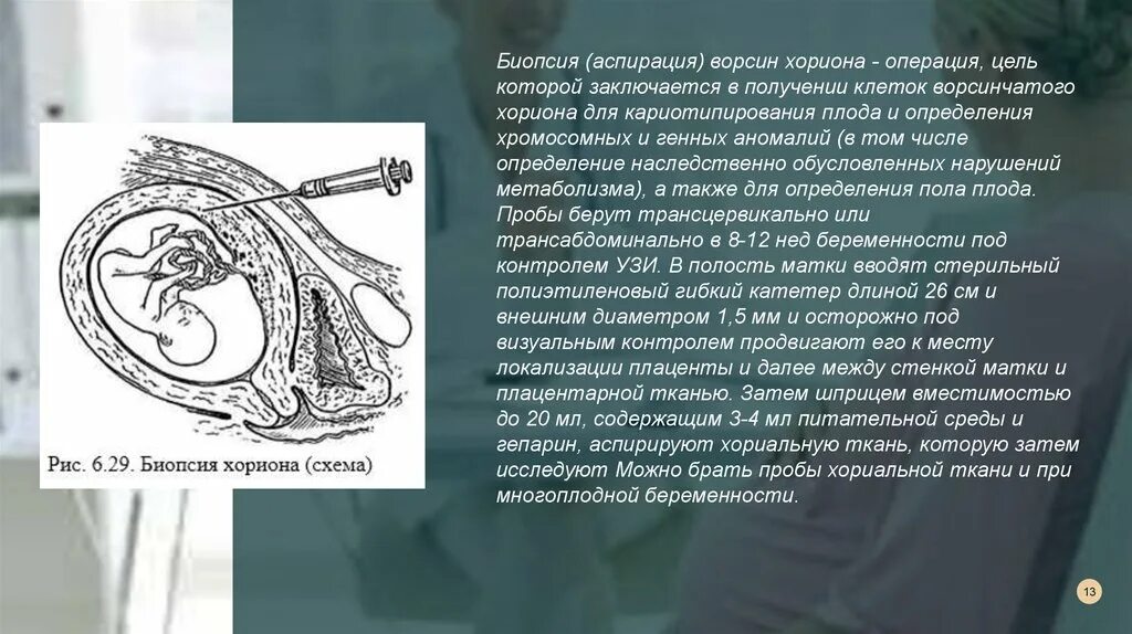 Биопсия хориона это. Трансабдоминальная биопсия ворсин хориона. биопсия ворстн хор она. аспирация ворсин хориона. биопсия ворсинок хориона.