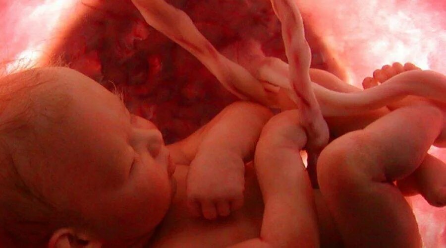 Плод в плаценте в утробе. Пуповина у ребенка в утробе. Шум в утробе матери