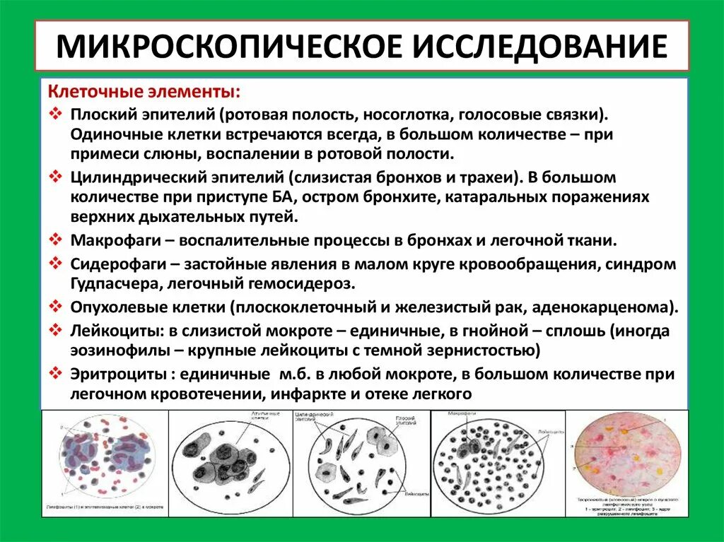 Включения мокроты. Клетки при микроскопии мокроты. норма лейкоцитов в микроскопическом исследовании мокроты. мокрота нативный препарат микроскопия. макроскопическое исследование мокроты.