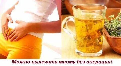 Народные лечения миомы