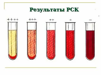Реакция связывания комплемента рск