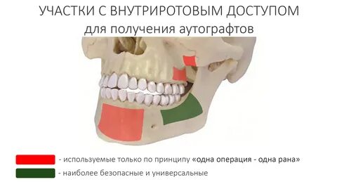 Костной ткани нижней челюсти