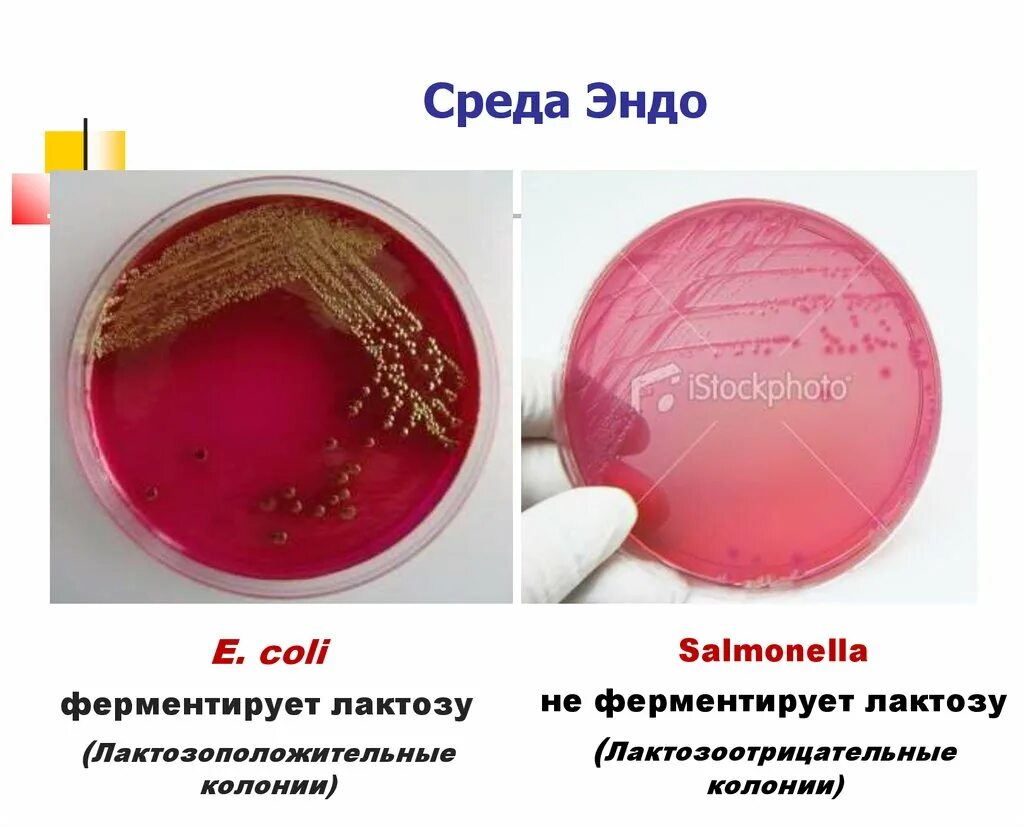 Среда для кишечной палочки. Рост бактерий на среде Эндо рисунок. Питательная среда Эндо микробиология. Среда Эндо лактозоположительные колонии. Рост бактерий на среде Эндо.