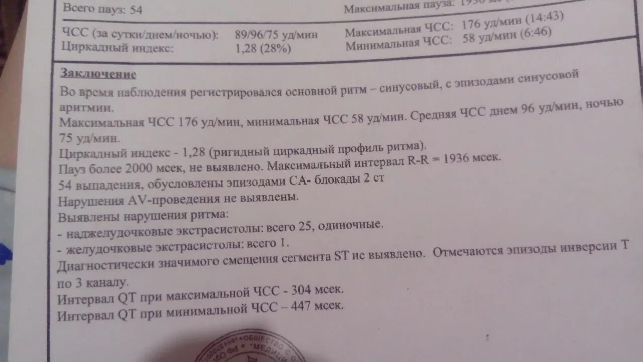 Заключение ЭКГ. Холтер заключение. ЭКГ заключение при АВ блокаде. Заключение ЭКГ при блокадах. Норма экстрасистол в сутки по холтеру