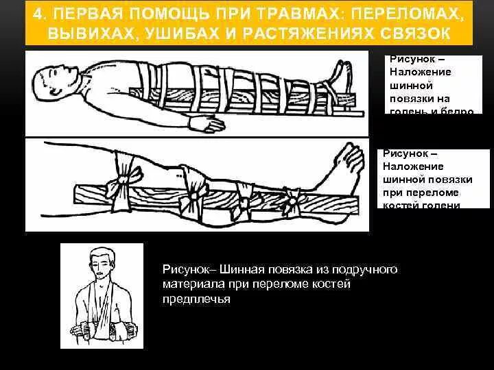 Реферат оказание первой помощи при травмах. Первую помощь при травмах:перелом, вывих, растяжение. Первая помощь при ушибах вывихах и переломах. Оказание первой доврачебной помощи при переломах и вывихах костей. Алгоритм оказания первой при переломах и вывихах.