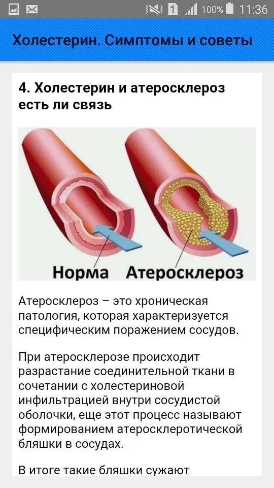 Холестерин. Атеросклероз проявления. Повышенный уровень холестерина причины. Холестерин в крови.