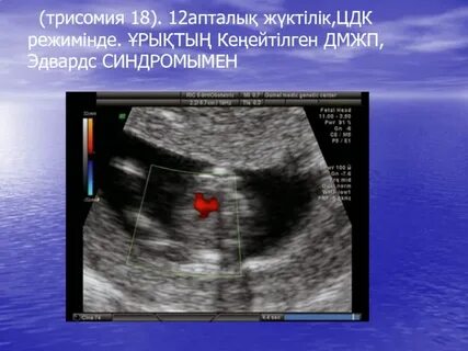 Ортағасырлық секс көріністері бейне