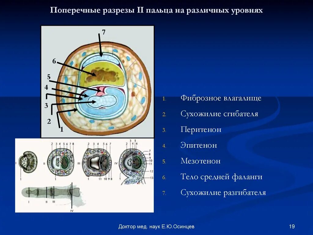 сухожильные влагалища разгибателей кисти. поперечный срез пальца топографическая анатомия. палец срез. кожа пальца человека толстая кожа препарат гистология. палец срез.