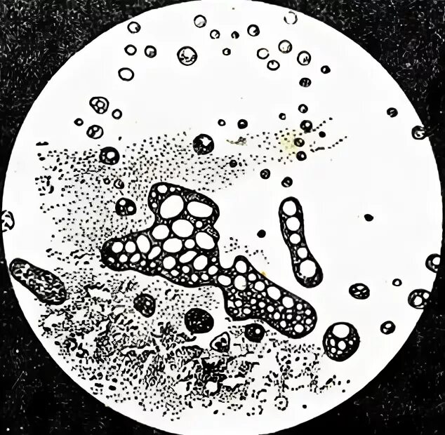 Коацерваты живые организмы. Протобионты и коацерваты. Коацерваты капли биология. Коацерватная капля под микроскопом. Пробионты рисунок.