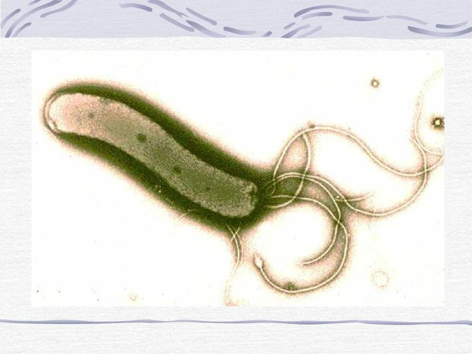 Helicobacter pylori ИФА кала. Хеликобактерии рисунок. Хеликобактерии микробиология рисунок. Определение хеликобактер в кале