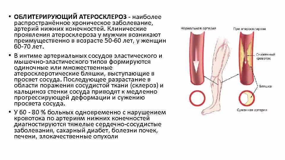 Гангрена карта вызова. Облитерирующий атеросклероз нижних конечностей. Облитерирующий атеросклероз артерий нижних конечностей пациенты. Облитерирующий атеросклероз артерий нижних конечностей клиника. Осложнение атеросклероза бедренных артерий.