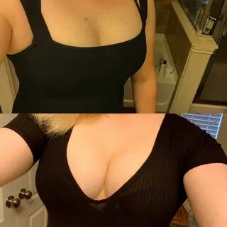 Reddit trans breast timelines