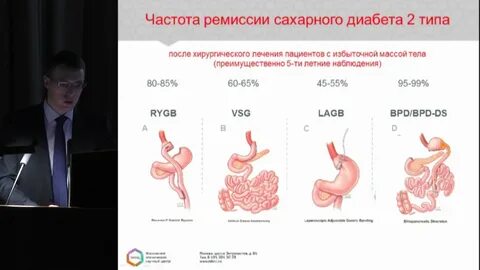 Операция при сахарном диабете
