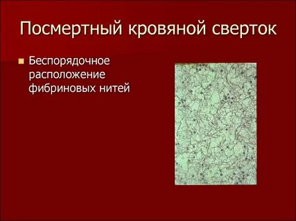 Отличие тромба от сгустка
