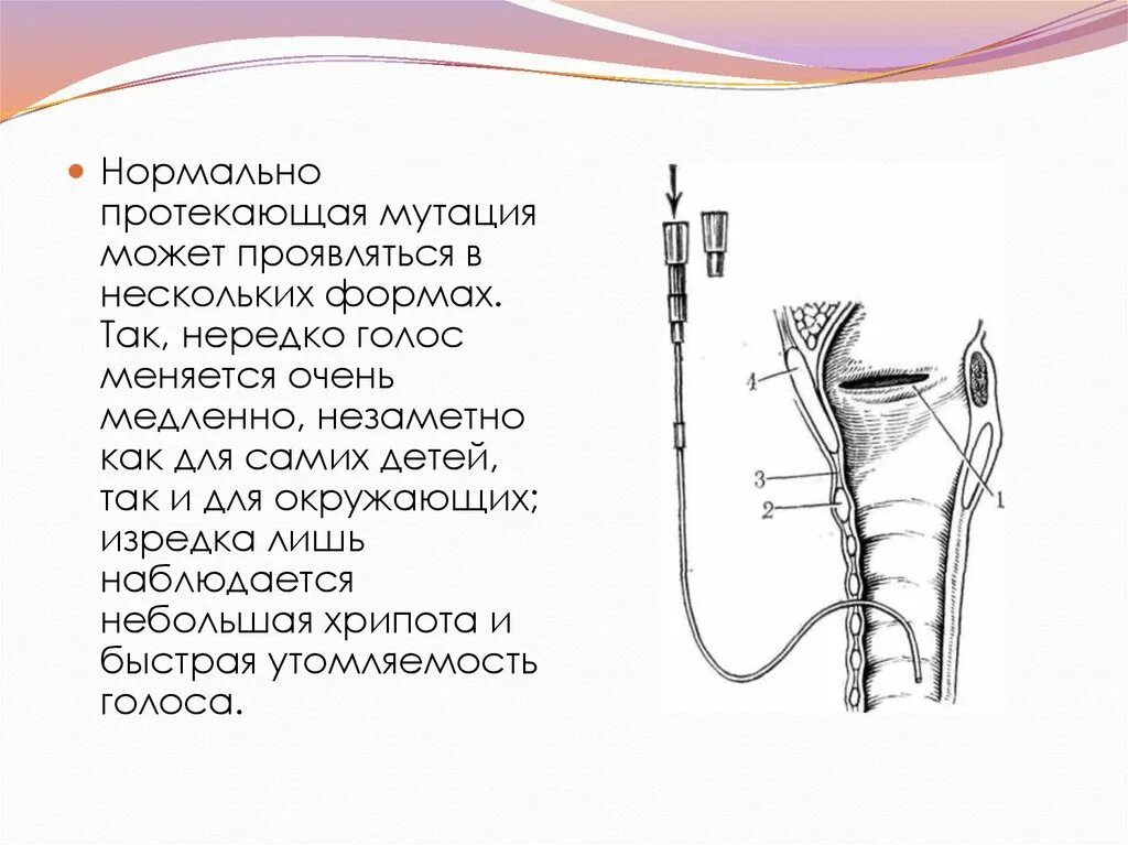 Изменить голос операции. Из за чего меняется голос. голосоподачи.