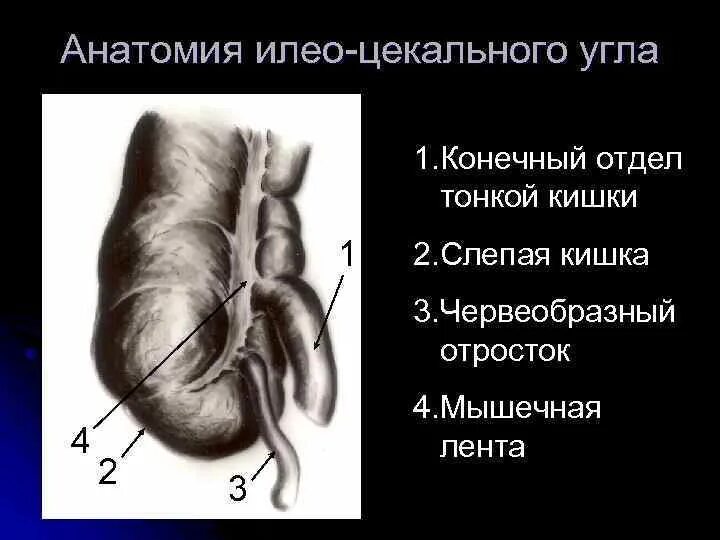 Слепая кишка стенки. Червеобразный отросток слепой кишки (аппендикс). Слепая кишка с аппендицитом. Строение червеобразного отростка анатомия. Червеобразный отросток слепой кишки латынь.