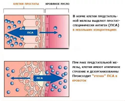 Кровь при простатите у мужчин. Простатический антиген (пса). Пса антиген простаты нормы. Исследование пса общий норма. Пса общий (простатический специфический НГ/мл АГ) 11.730*.