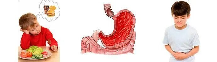 Заболевания желудка у детей. Болезни пищеварительной системы у детей острый гастрит. Болезни пищеварительной системы у детей язвенная болезнь. Хронический гастрит гастродуоденит и язвенная болезнь у детей.