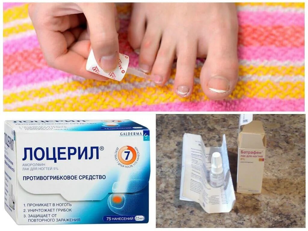 Эффективное лечение грибка ногтей рук. Средство от грибка ногтей. Лекарство от грибка ногтей. Капли от грибка ногтей. Противогрибковое средство для ногтей на ногах.