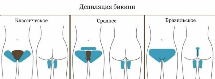 Чем отличается бикини от тотального бикини. Зона глубокого бикини. классическое бикини бразильское. шугаринг зоны бикини классика.