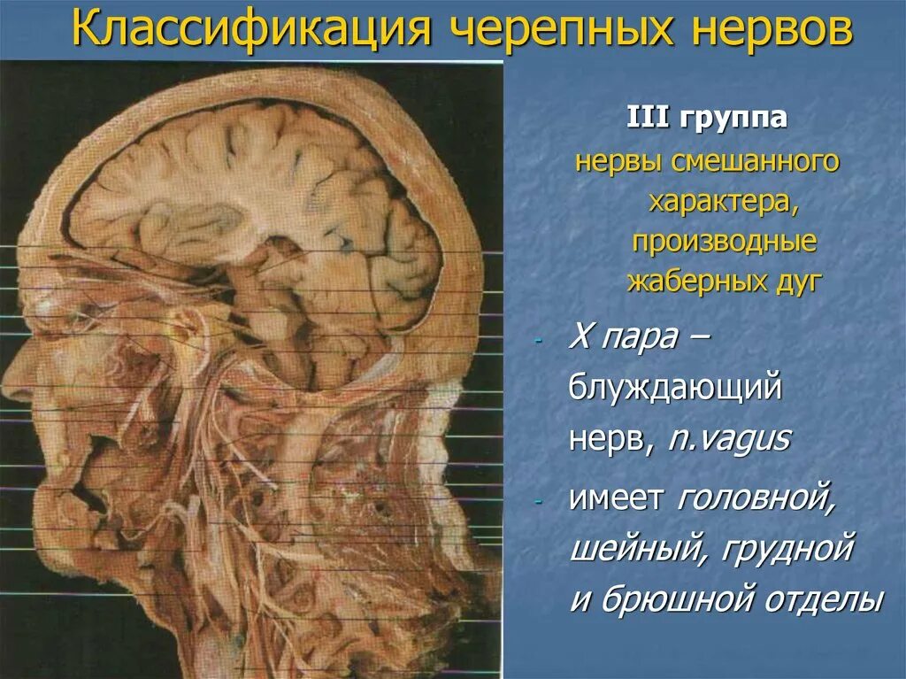 Укажите черепной нерв. Черепные нервы классификация. Группы черепных нервов. Классификация черепных нервов. III Черепные нервы.