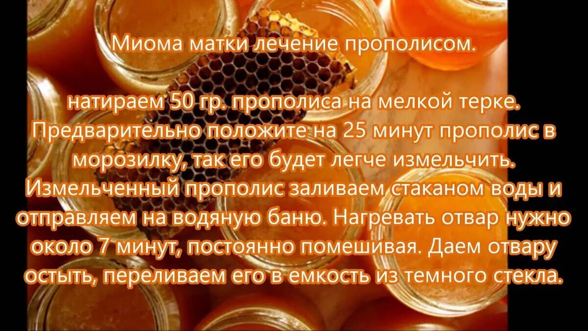 Народные средства от миомы. Миома матки лечение народным средством. Народные средства при миоме. Лечим миому матки народными средствами.