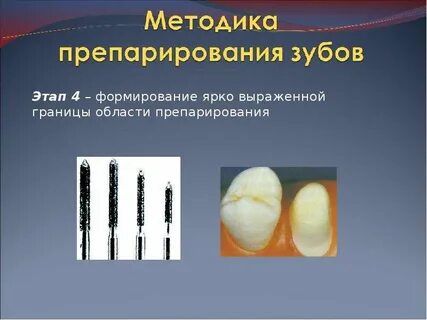 Методы препарирования твердых тканей зуба