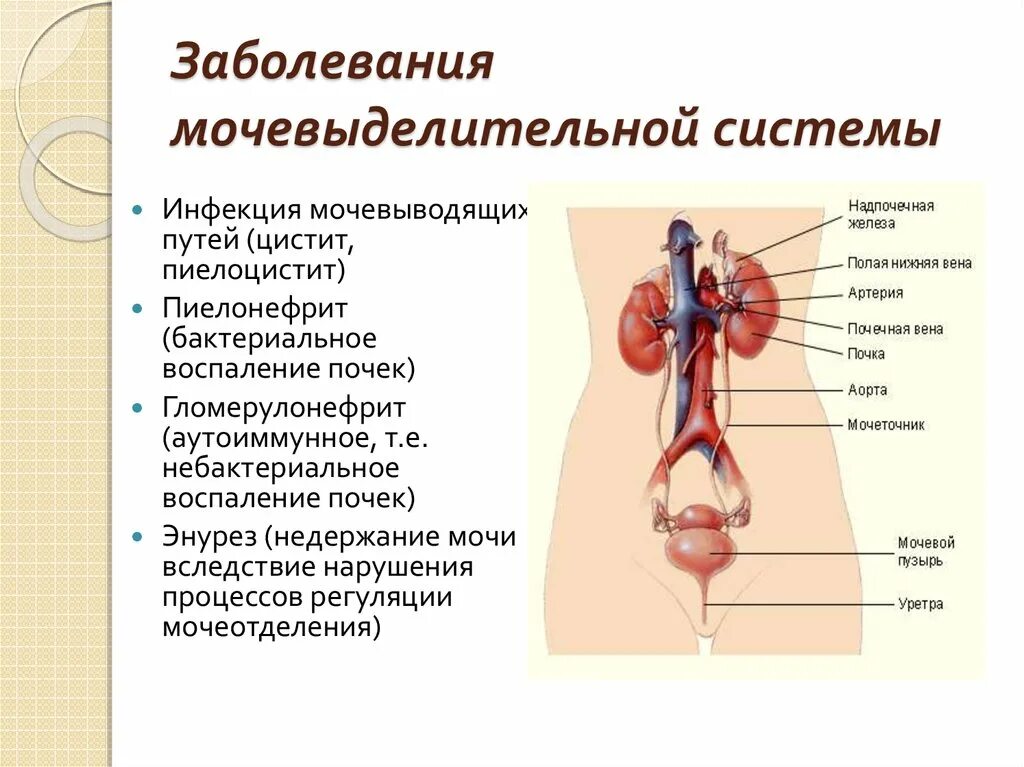 Заболевания мочевыделительной системы описание