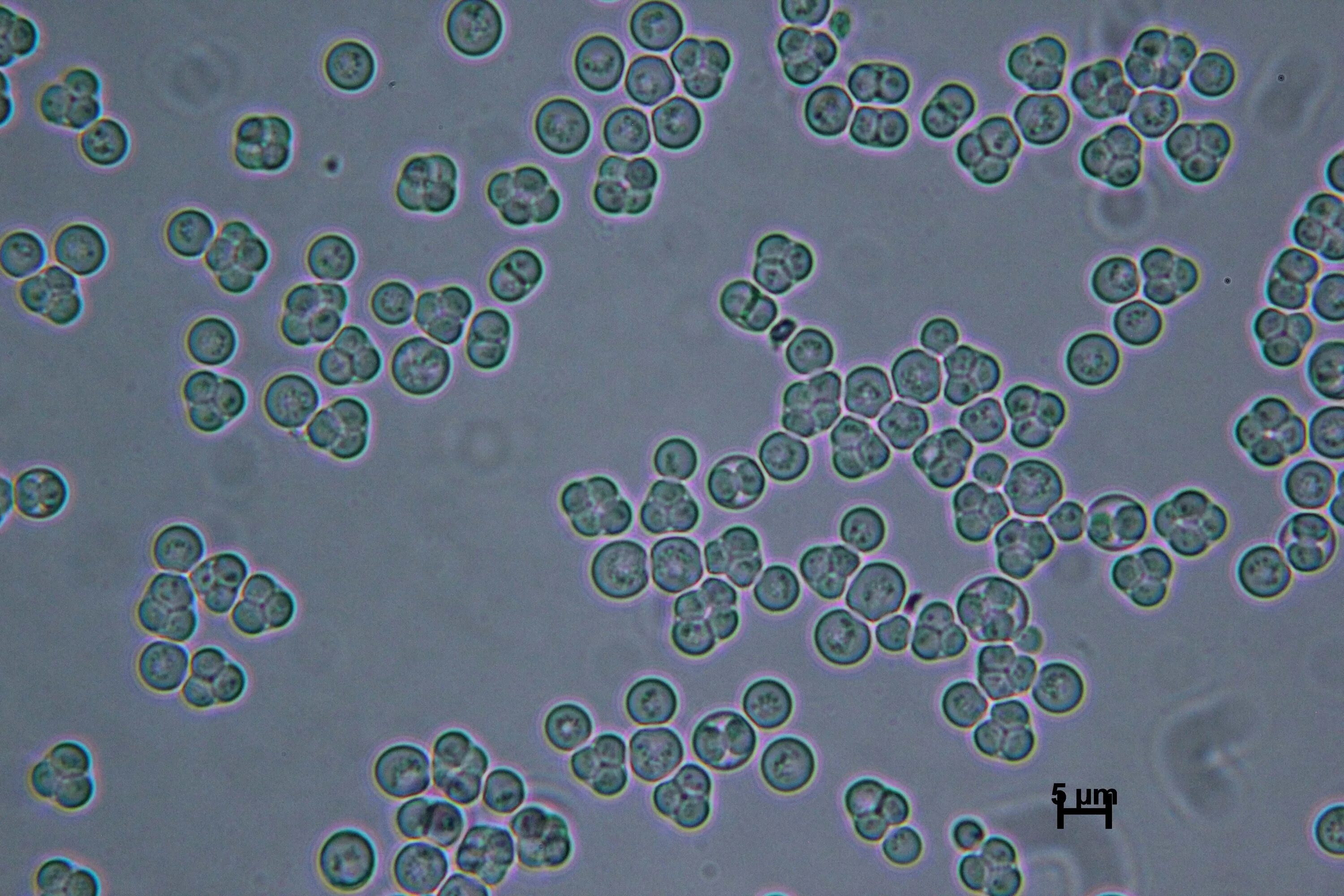 Споры candida. Клетку дрожжей Saccharomyces cerevisiae. Дрожжей Saccharomyces cerevisiae микроскопия. Одноклеточные дрожжи Saccharomyces cerevisiae. Saccharomyces cerevisiae микроскоп.