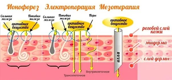 Ионофорез схема. Электропорация в косметологии. Ultrasonic ion skin scrubber инструкция на русском. Дезинкрустация схема. Гальванизация в косметологии.