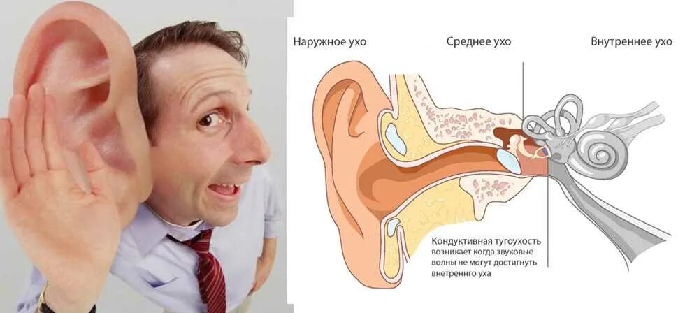 Шум в ушах месяц. Профессиональная нейросенсорная тугоухость патогенез. Кондуктивные нарушения слуха. Проявления нарушения слуха.
