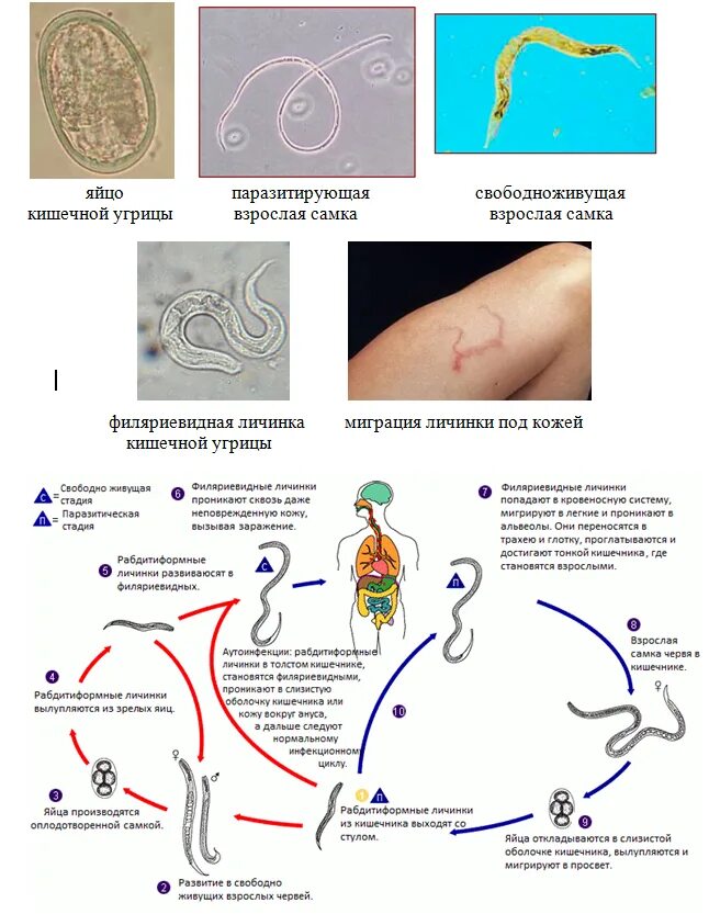 Угрица кишечная цикл развития. Цикл развития угрицы кишечной схема. Strongyloides stercoralis жизненный цикл.