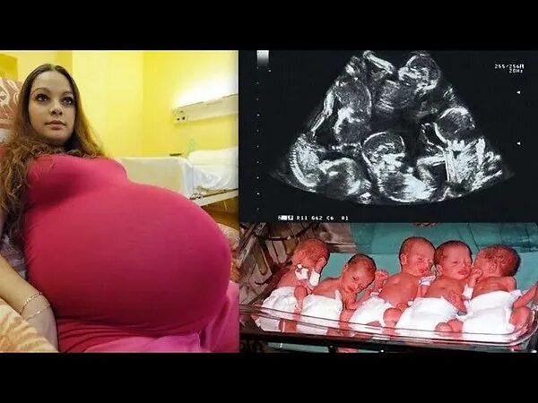 Живот на 5 месяце беременности. Многоплодная беременность 5 детей. Пять детей в животе. Самые беременные женщины. Огромный живот беременной двойней.