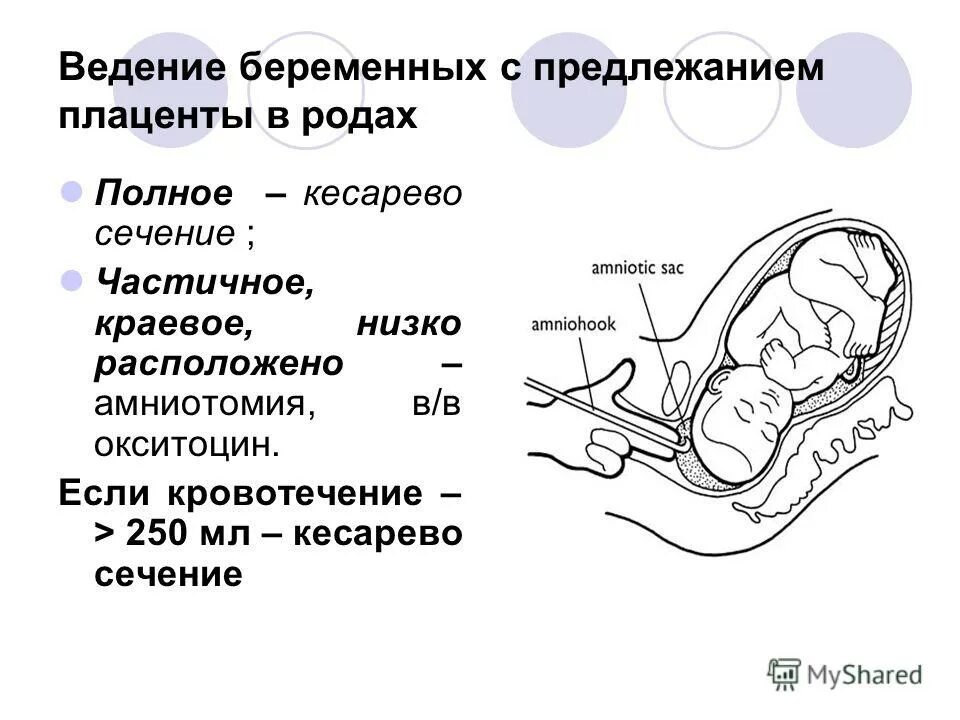 Плацента при кесаревом сечении