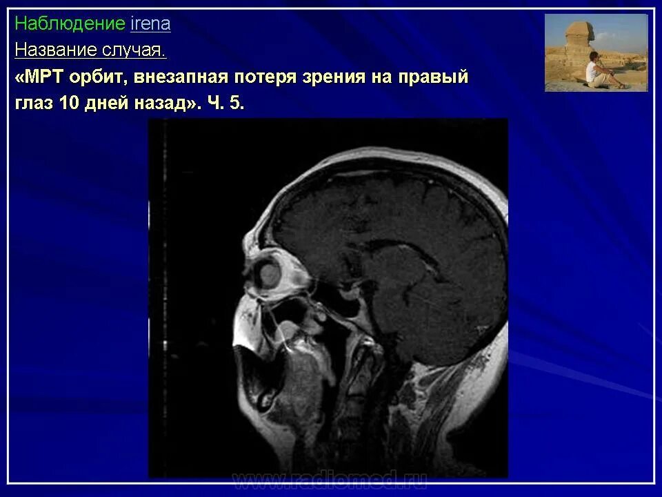 Данные кт. Данные кт