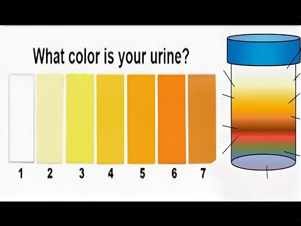Какого цвета должна быть моча у мужчин. Цвет мочи у щенка. Темно желтая моча. Желто оранжевая моча. Моча темно оранжевая причины.