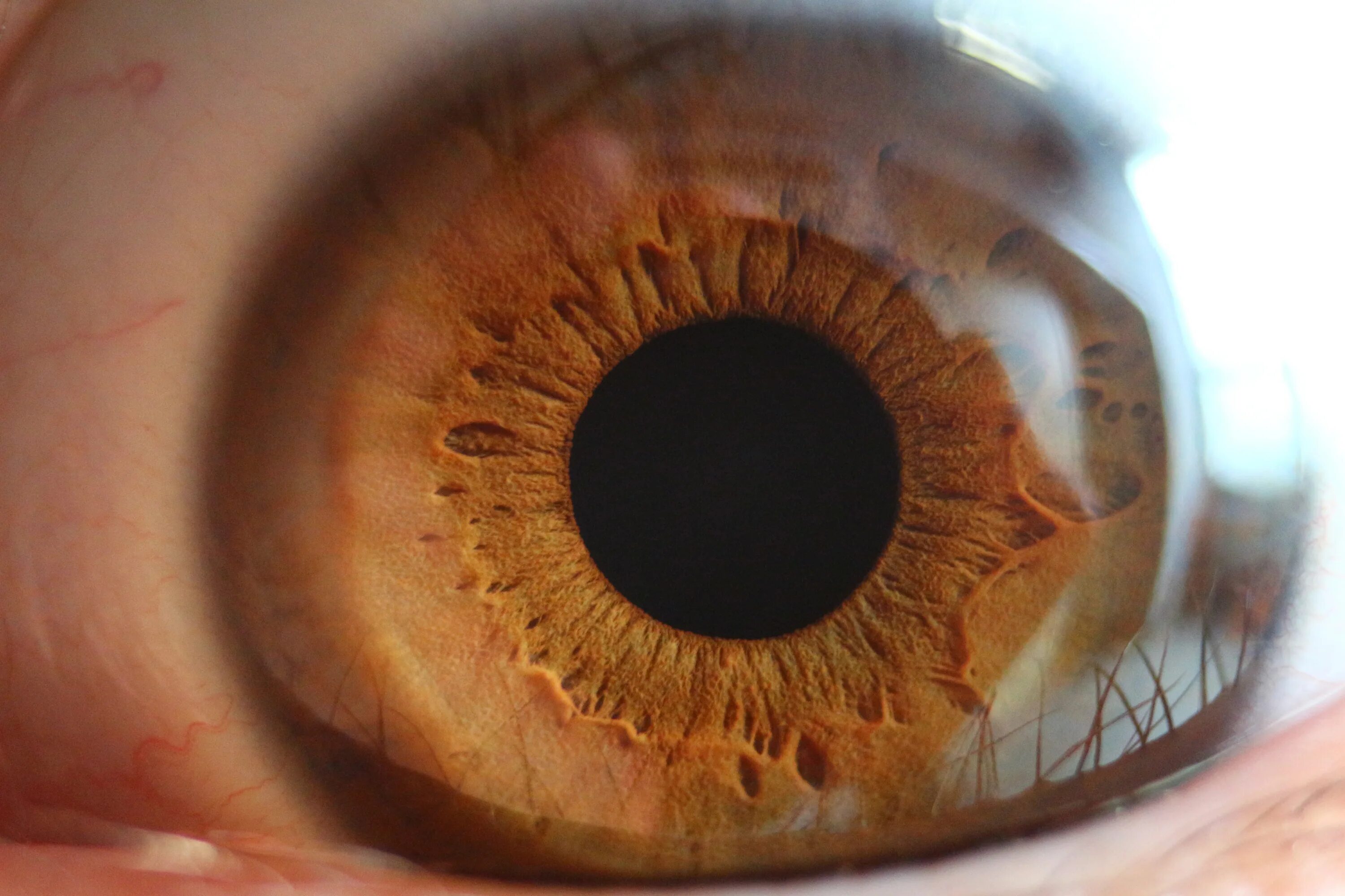 Каряя радужка. Нейрофиброматоз Радужки. Глазной зрачок. Радужка глаза. Фото Радужки глаза.