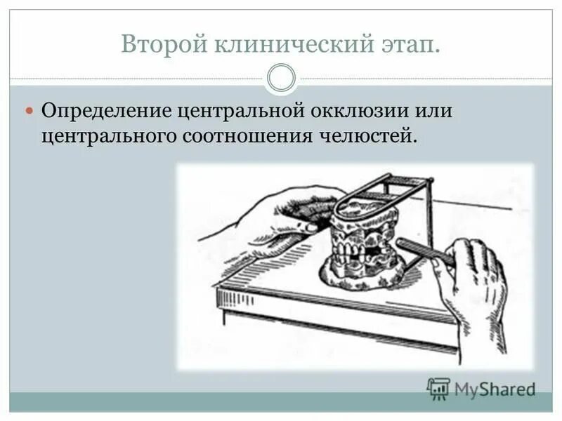 Этапы лабораторной работы. Этапы определения центральной окклюзии. Определение центрального соотношения челюстей. Клинические этапы изготовления штампованных коронок.