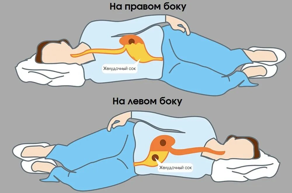 Как лечь при боли в животе. Как лечь при боли в животе