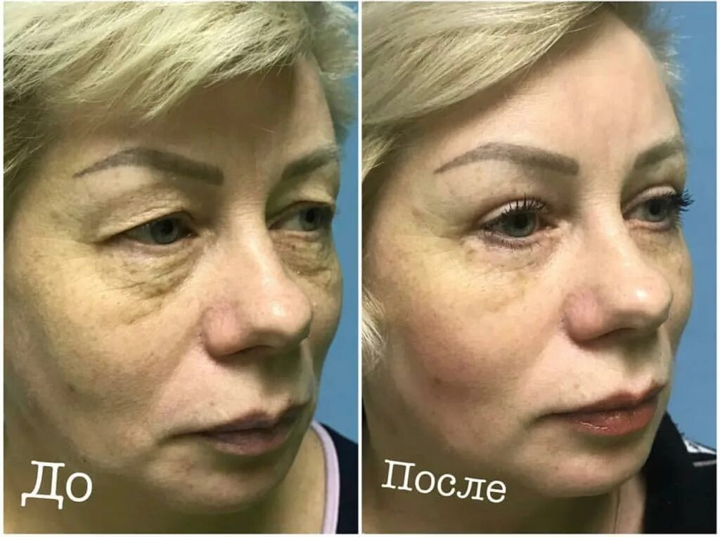 мастер класс пластическая хирургия. пластический хирург самара отзывы. николаенко игорь леонидович пластический. пластический хирург самара отзывы. блефаропластика лучший хирург.