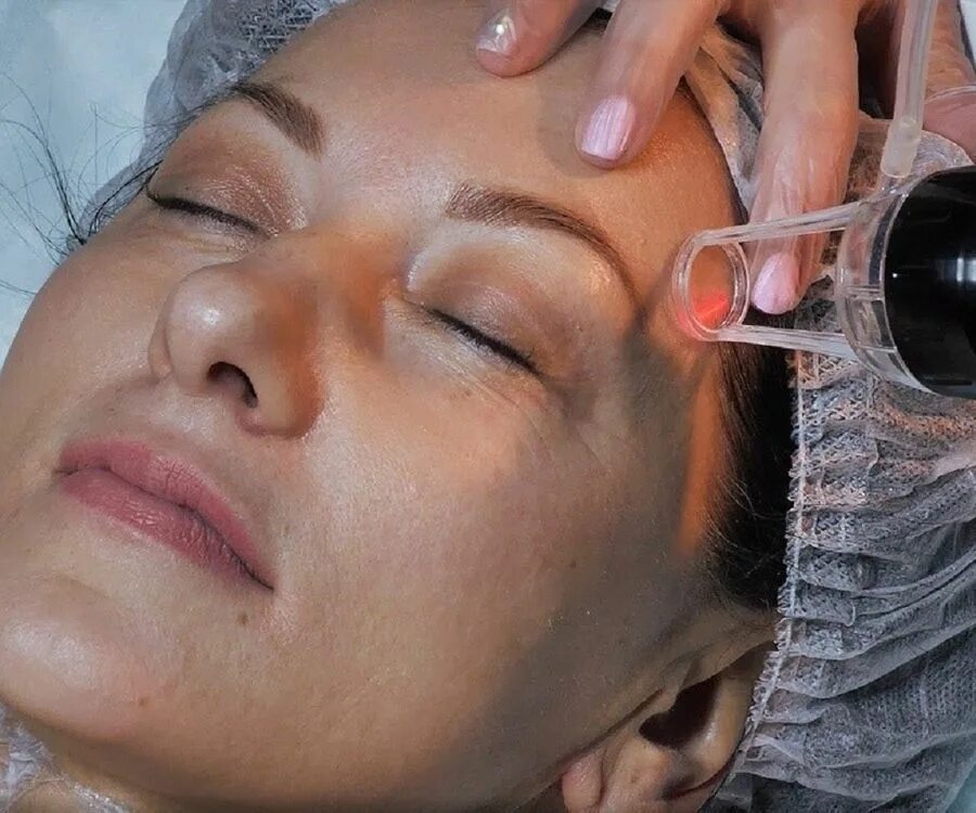 Пилинг для глаз. Маска для лица косметическая. Пилинг желтый ретиноловый аркадия. Маска для лица. Алмазная шлифовка лица до и после.