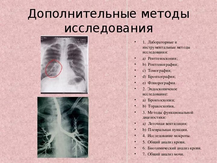 Как называется исследование легких. Инструментальные исследования пневмонии. инструментальное исследование при пневмонии. инструментальные исследования при пневмонии. инструментальный метод при пневмонии.