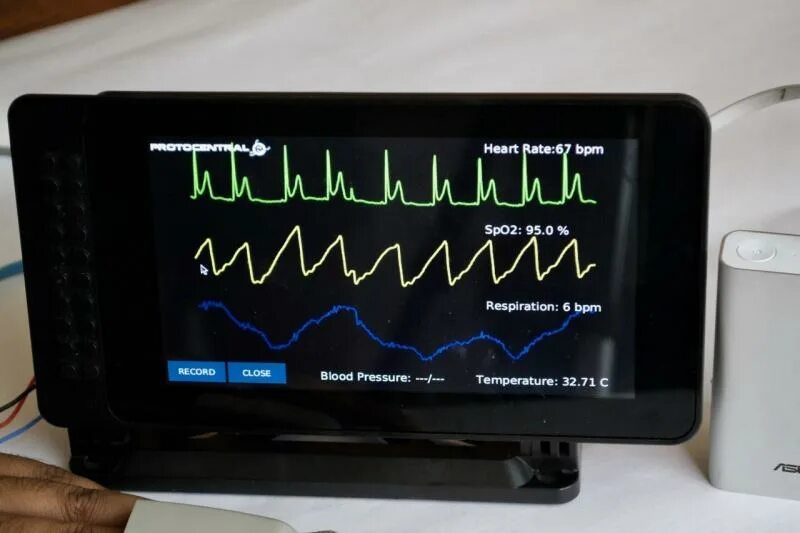 Temperature monitor. Monitoring devices. temperature monitoring. температурный монитор 218. мониторинг температуры человека.