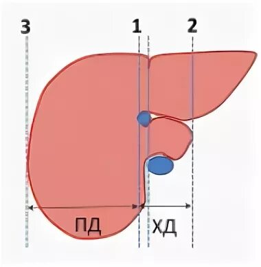 Размеры печени в норме. Размеры печени на УЗИ. Размеры долей печени. Размеры печени в норме у взрослых.