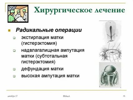 Гистерэктомия экстирпация матки
