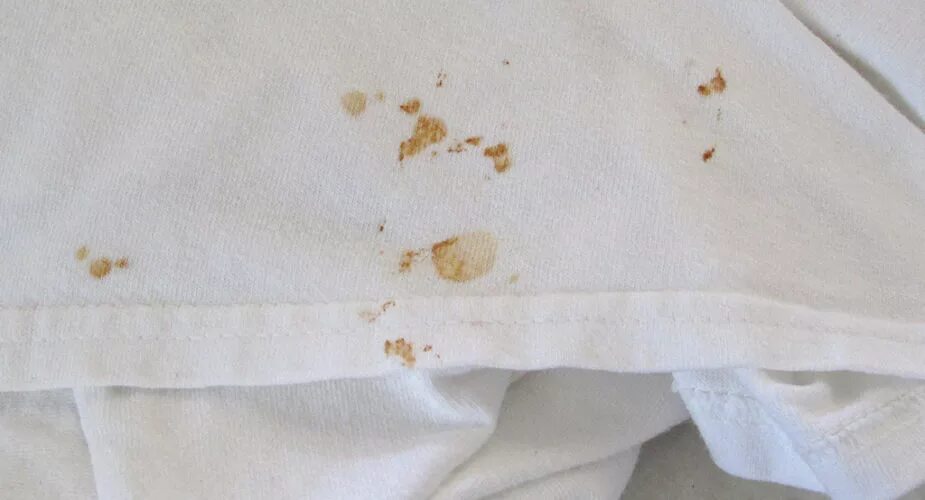 Пятна от белизны на белом. Пятна на одежде. Оранжевые пятна на одежде. Пятна на одежде. Желтые следы на одежде.