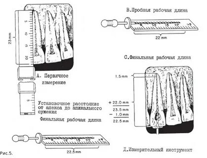 Определение рабочей длины