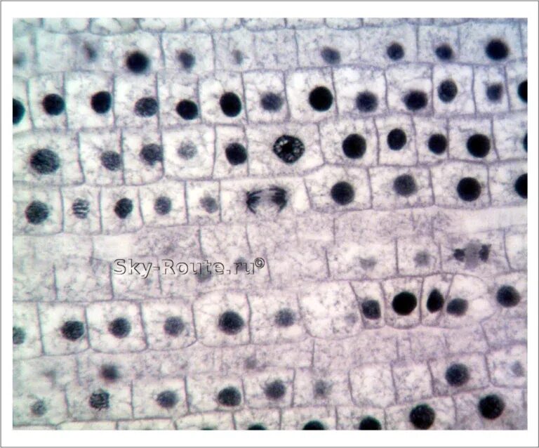 Рассмотрите микропрепараты растительных тканей под микроскопом Fichier:Herbaceous Dicot Stem Medicago (37141703136).jpg Wikipédia