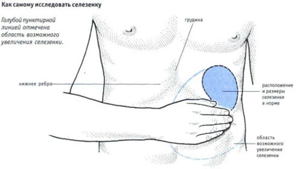 Гдетнаходится селезенка. Селезёнка где находится. Где находится селезенка у человека. Как болит селезенка в левом боку